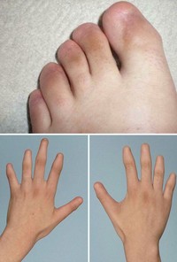 Beberapa orang berikut memiliki bagian tubuh yang unik, tak biasa. Adakah kondisi yang juga kamu miliki?