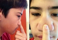 Beberapa orang berikut memiliki bagian tubuh yang unik, tak biasa. Adakah kondisi yang juga kamu miliki?