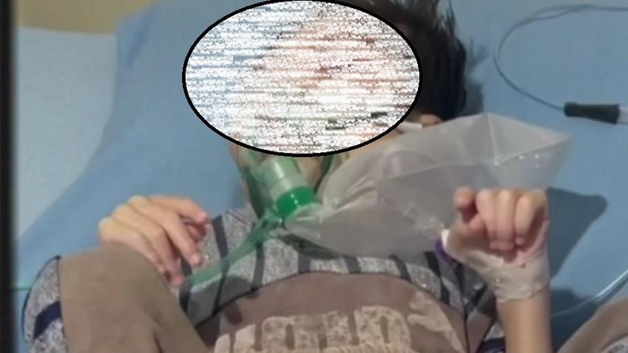 Bocah 4 tahun di Palembang alami gizi buruk