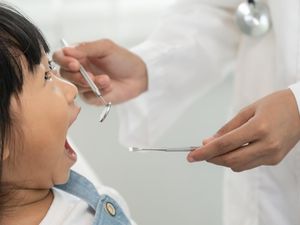 90 Persen Anak RI Alami Karies Gigi, Kenali Pemicu dan Cara Mengatasinya