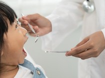 90 Persen Anak RI Alami Karies Gigi, Kenali Pemicu dan Cara Mengatasinya