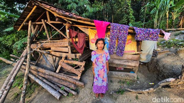 Kisah Etin Tinggal di Kandang Domba, Bupati Sukabumi Turun Tangan