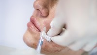 Viral di Sosmed, Skin Booster Kolagen Korsel Ini Pakai Jaringan Kulit Mayat