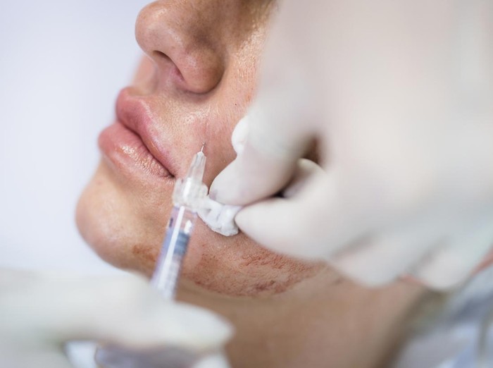 Ilustrasi skin booster