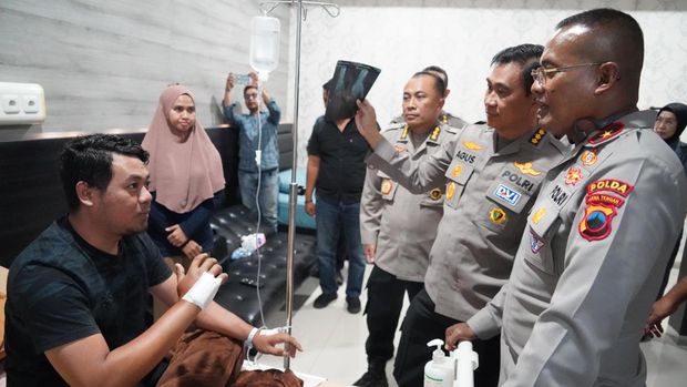 Wakapolda Jateng, Brigjen Usman Latif, menjenguk lima anggotanya di Rumah Sakit Bhayangkara Semarang, Selasa (2/9/2025).