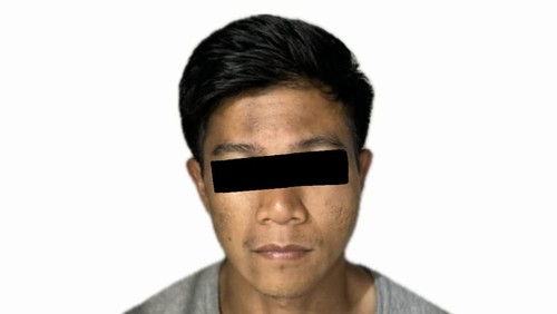 IS (29), pencuri kartu kredit dan penganiaya pensiunan polisi Australia di hotel bilangan Kelurahan Legian, Kecamatan Kuta, Badung, Bali, Senin (1/9/2025). (Dok. Polsek Kuta)