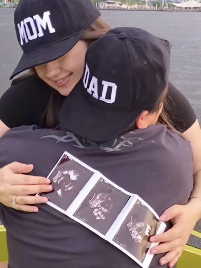 Vika Kolesnaya dan Billy Syahputra menanti kelahiran anak pertama.