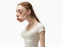 Begini Wajah Influencer Tahun 2050, Tubuh Bungkuk & Kulit Iritasi