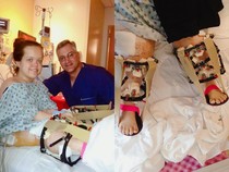 Foto: Perubahan Wanita AS usai Operasi Peninggi Badan, Dari 117 Cm ke 151 Cm