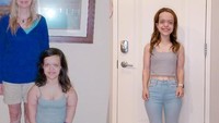 Seorang wanita d Maryland, Amerika Serikat bernama Chandler Crews (31) menceritakan pengalamannya menjalani operasi peninggi badan. Diketahui, Chandler mengidap kondisi achondroplasia yang membuat tinggi badannya hanya 117 cm. (Foto: Instagram @chancrews)