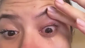 Mata kiri Marsha Aruan langsung merah dan berair, sekilas kayak habis nangis. Foto: Instagram Marsha Aruan