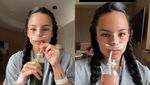 Shafa Harris Tergila-gila Hasil OP Hidung