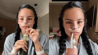 Shafa Harris menjalani operasi hidung kedua di Thailand. (Foto: dok Instagram shafaharris)