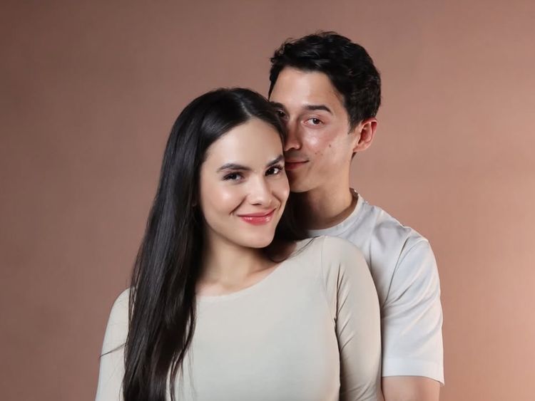 Foto: Nino Fernandez-Steffi Zamora Umumkan Kehamilan, Pamer Baby Bump-Foto USG