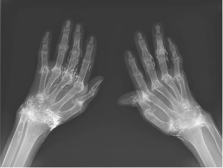 Merinding! Foto-foto Penampakan Ratusan Benda Tak Kasat Mata di Tubuh Pasien