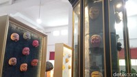 Museum menampilkan berbagai koleksi menarik, termasuk topeng panca wanda yang terdiri dari Panji, Samba, Rumyang, Tumenggung, dan Kelana. Selain itu, ada wayang cepak yang dipamerkan lengkap dengan miniatur panggung pementasan.