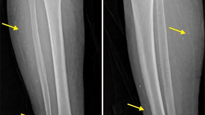 Penampakan benang emas dalam tubuh