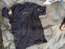 Penemuan Kerangka Manusia dalam Pohon di Sergai, Pakaian Jadi Petunjuk