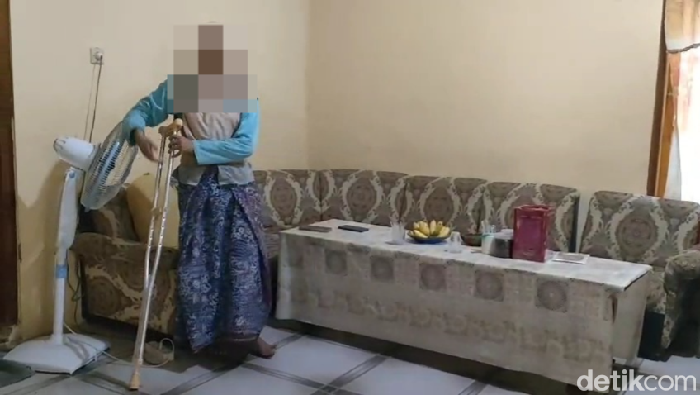 Duwi Pertiwi (24) yang pake alat bantu kruk