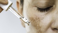 Peringatan Dermatolog, Sefatal Ini Efeknya Pakai Skincare Berkedok 'Putih Instan'