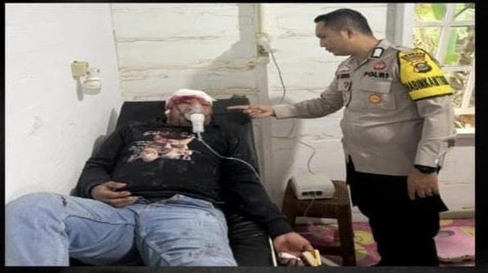 Korban saat menjalani perawatan usai dibacok rekannya