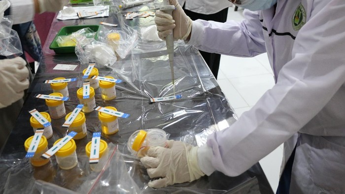 Pemeriksaan TB-LAM Urine
