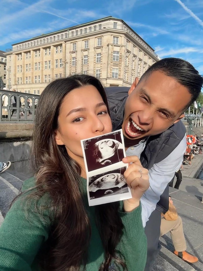 Susan Sameh Susan Sameh umumkan hamil anak pertama, Jumat (12/9/2025).