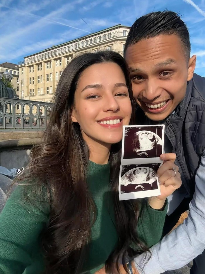 Susan Sameh umumkan hamil anak pertama, Jumat (12/9/2025).