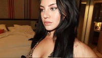 Shafa Harris yang dikenal setelah melabrak Jennifer Dunn itu mengaku tergila-gila atas hasil operasi hidung. Gila, ini baru 7 hari pasca operasi, pembengkakan akan terus berkurang sedikit demi sedikit, dan hasil akhirnya tidak akan terlihat sepenuhnya sampai sekitar 6 bulan hingga setahun. Jujur, saya tidak sabar menunggu, tulisnya di Instagram Stories, Minggu (14/9/2025). (Foto: dok Instagram shafaharris)