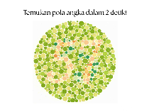Tes Buta Warna! Tak Bisa Tebak Angka di Gambar Ini, Tandanya Harus Periksa