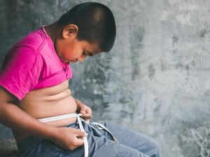 Indonesia Vs Obesitas, Double Burden di Tengah Masalah Gizi Anak