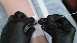 Tato Braille, Sentuhan Unik dari Seniman Tunanetra Rusia