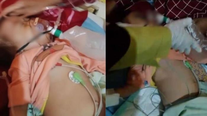 Balita penderita penyakit cacingan di Seluma.