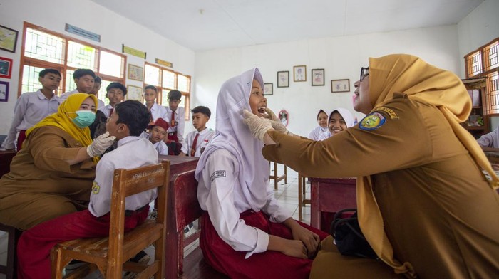 Petugas kesehatan puskesmas Balongan memeriksa kesehatan gigi siswa pada kegiatan Cek Kesehatan Gratis (CKG) Sekolah di SDN Gelarmandala, Balongan, Indramayu, Jawa Barat, Selasa (16/9/2025). Kementerian Kesehatan (Kemenkes) menyebutkan pelaksanaan pr