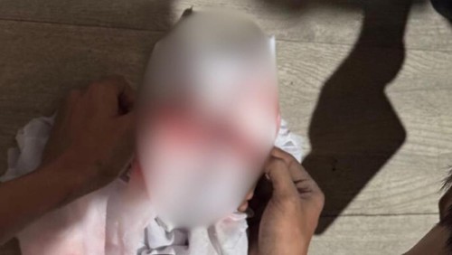 Orok bayi yang digugurkan seorang mahasiswi asal Lombok Tengah, NTB, Senin (15/9/2025). (Foto : Polsek Ampenan/detikBali).