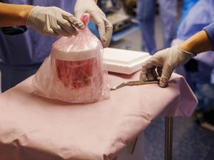 Peneliti AS Semakin Dekat Wujudkan Transplantasi Ginjal Babi untuk Manusia