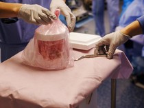 Peneliti AS Semakin Dekat Wujudkan Transplantasi Ginjal Babi untuk Manusia