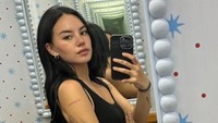 Shafa Harris menjelaskan soal revisi hidung yang dilakukan di Thailand. Kali ini saya menambahkan volume pada bagian pangkal hidung, mengecilkan ujungnya, dan melakukan alarplasty untuk menyeimbangkan lubang hidung, tulisnya. (Foto: dok Instagram shafaharris)