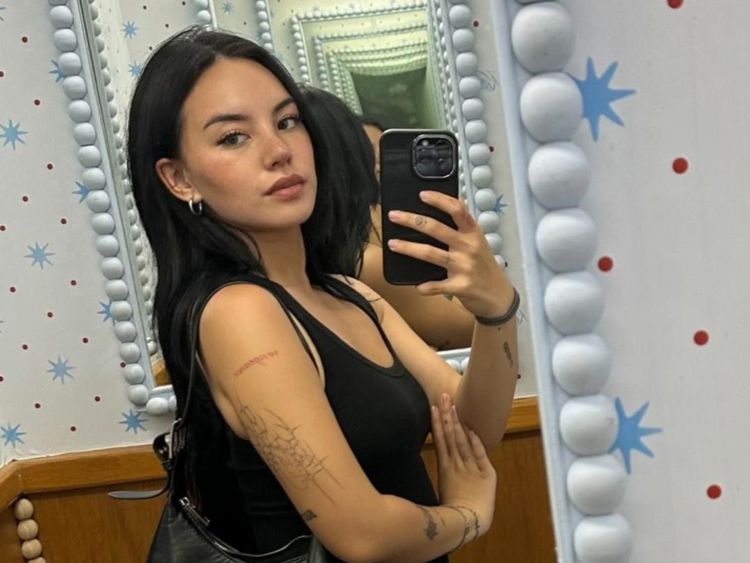 Shafa Harris Rogoh Rp 384 Juta Revisi Hidung, Ungkap Alasan OP Ulang