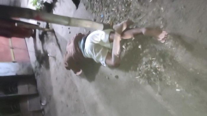 Mahasiswa korban pengeroyokan di Pasuruan