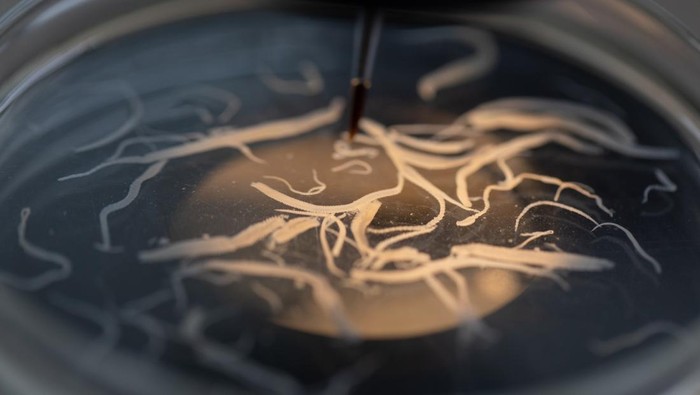 Pria 35 Tahun Ngeluh Susah Pipis, Dokter Kaget Temukan Cacing di Alat Kelaminnya