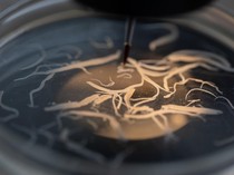 Peliknya Masalah Gizi Anak di Balik Viralnya Kasus Kecacingan di Indonesia