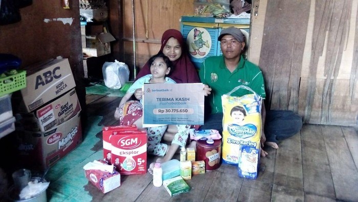 Sahabat Baik Bantu Kebutuhan April, Anak Tukang Becak Penderita Mikrosepalus