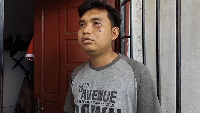 Pengakuan Andre Dianiaya OTK Diduga Pakai Senpi, Pelaku Dendam