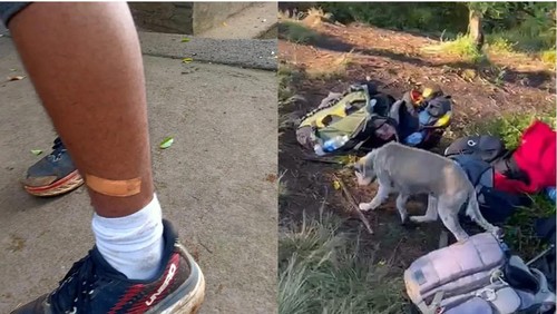 Anjing liar yang diduga rabies menggigit belasan pendaki di jalur pendakian Gunung Batukaru, Tabanan, Minggu (21/9/2025).