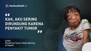 Dirundung Mirip Alien, Anak Tukang Ojek Ingin Hidup dengan Rasa Aman Dirundung Mirip Alien, Anak Tukang Ojek Ingin Hidup dengan Rasa Aman