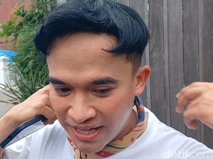 Anwar BAB Gelontorkan Rp 80 Juta untuk Perawatan Rambut