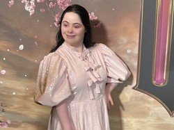 Kisah Model Down Syndrome yang Mendunia, Cetak Sejarah di Vogue Inggris