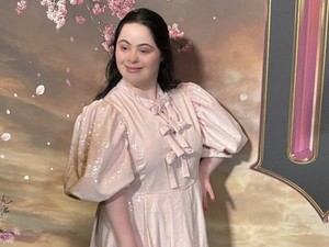 Kisah Model Down Syndrome yang Mendunia, Cetak Sejarah di Vogue Inggris