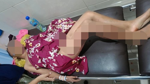 Muhamad Rizki Alfarido (9) terbaring di puskesmas setelah diserang anjing liar di Desa Terara, Lombok Timur, NTB, Senin (22/9/2025). (Dok. Polres Lombok Timur)